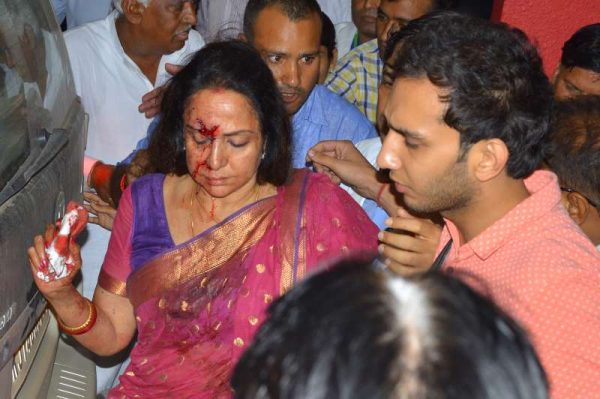  Actress and BJP MP Hema Malini being taken to hospital in a in Jaipur on July 2, 2015 after being injured in an car accident near Dausa