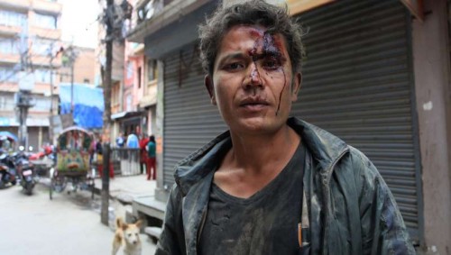 A man is injured after earthquake in Kathmandu, Nepal, April 25, 2015. More than 100 people are so far known to have been killed in a strong earthquake which hit large parts of Nepal on Saturday, including dozens in capital Kathmandu, sources here said. 