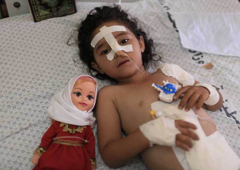 Shayma al-Masri, a four-year-old Palestinian girl is treated at a hospital in Gaza