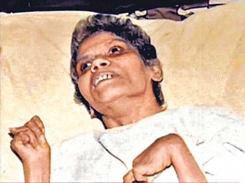 Aruna Shanbaug