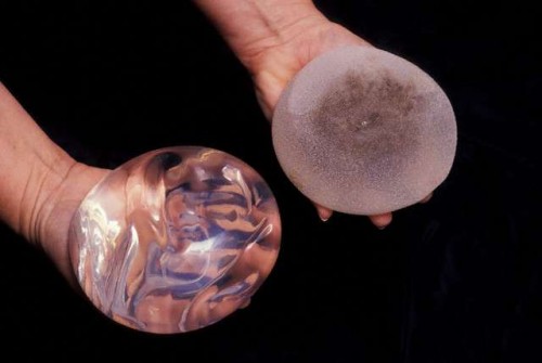 types-of-breast-implants